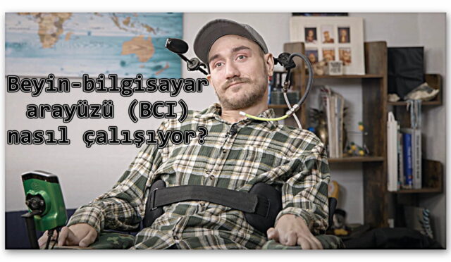 Beyninde ‘Zihin Okuma Çipi’ Bulunan Adam Bir Yıllık Deneyimini Paylaştı: