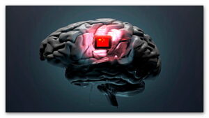 Çin, beyin implantı yarışına katılıyor